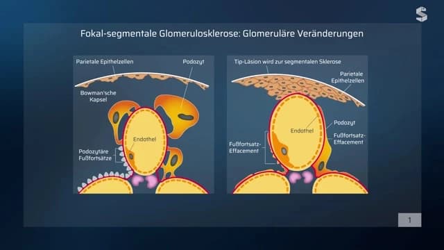 Video Vorschaubild