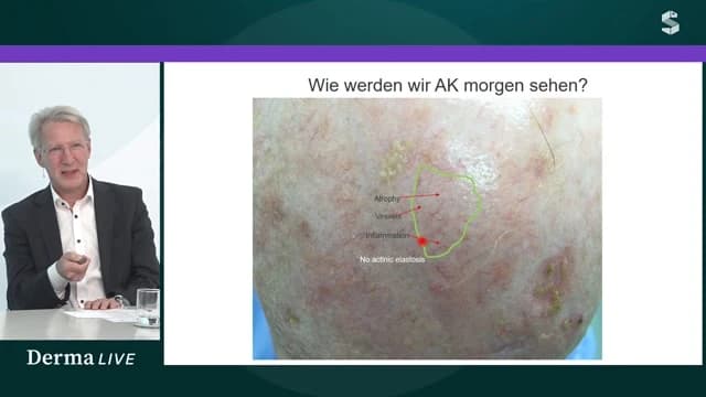 Video Vorschaubild