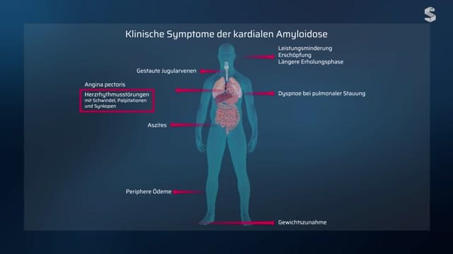 Video Vorschaubild