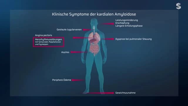 Video Vorschaubild