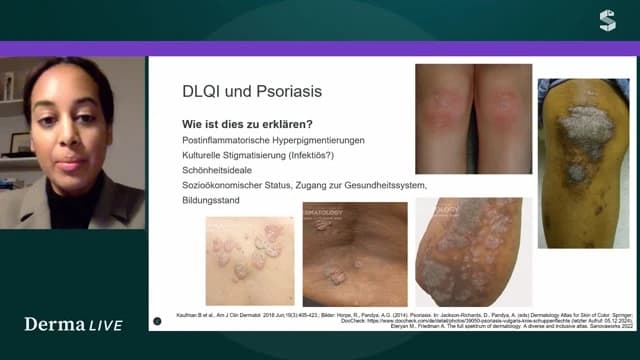 Video Vorschaubild