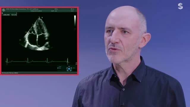 Video Vorschaubild