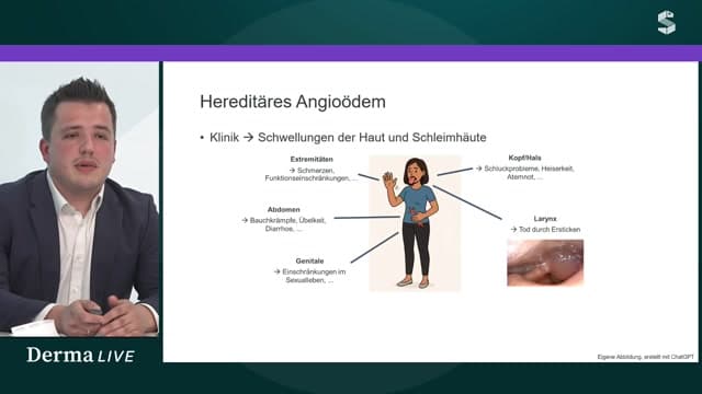 Video Vorschaubild