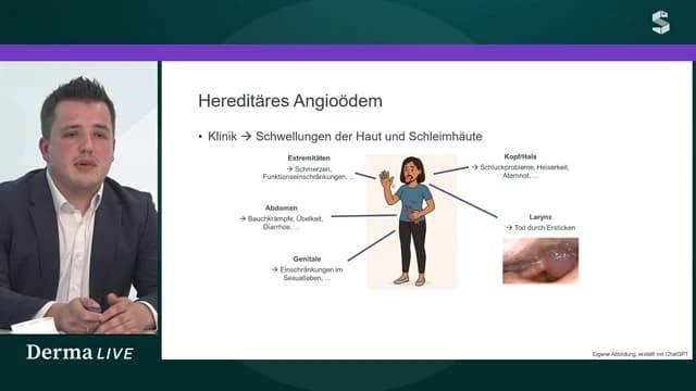 Video Vorschaubild