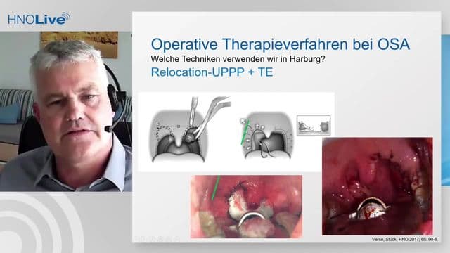 Video Vorschaubild
