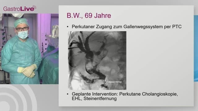 Video Vorschaubild