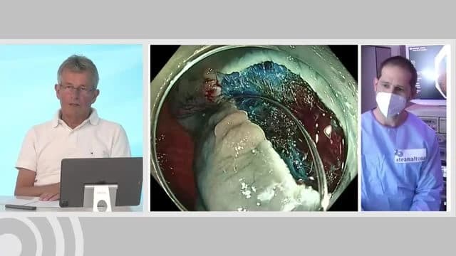 Video Vorschaubild