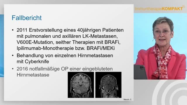 Video Vorschaubild
