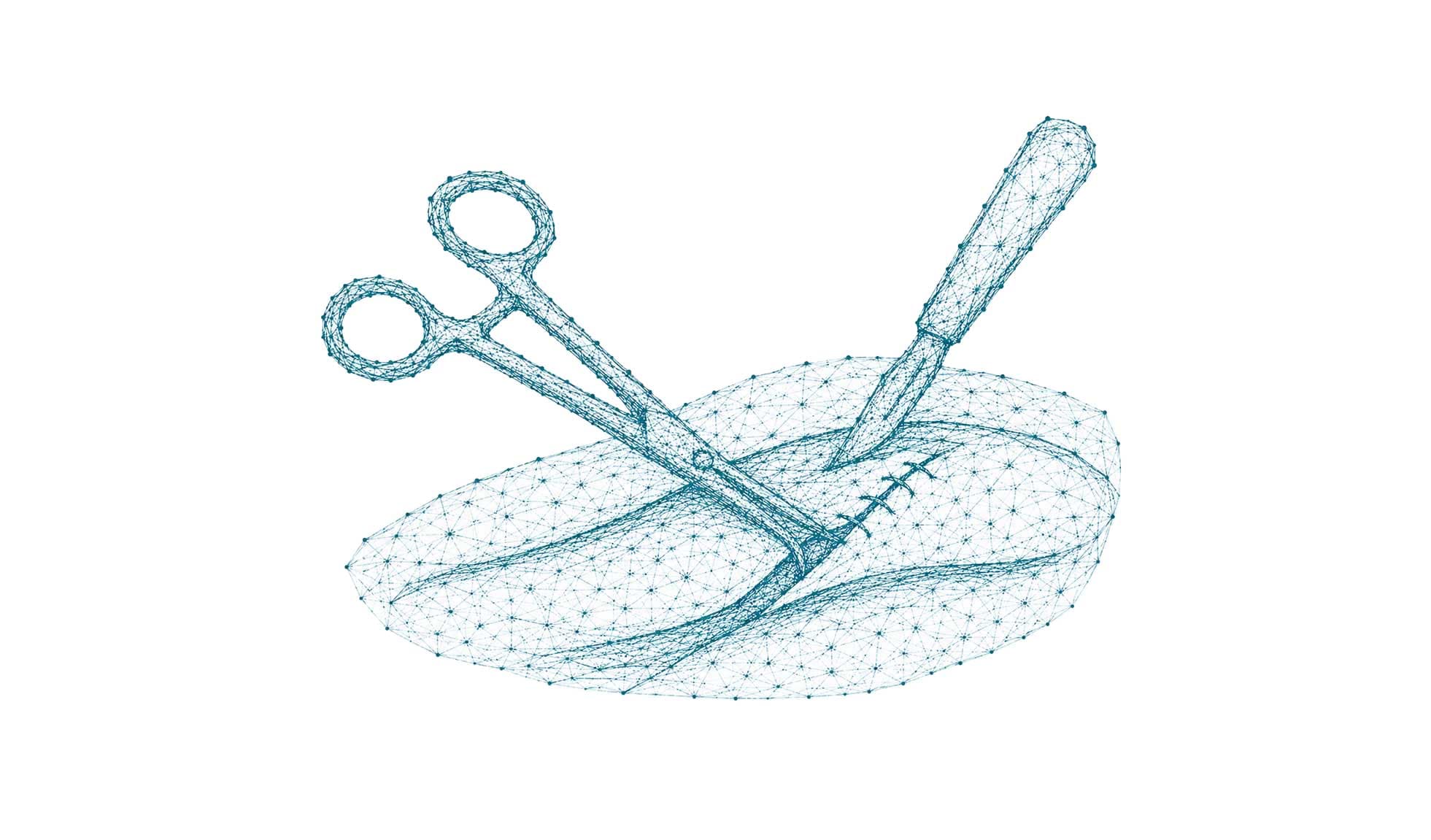 Operationssitus mit Wundspreizer, chirurgischem Instrument und Nahtmaterial als Symbolbild für die Allgemeinchirurgie