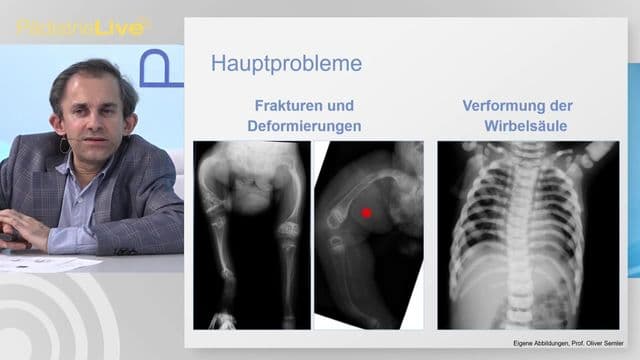 Video Vorschaubild