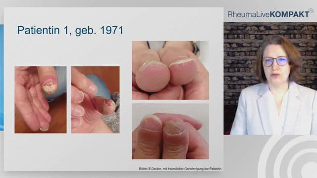 Video Vorschaubild