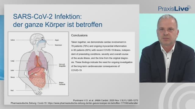 Video Vorschaubild